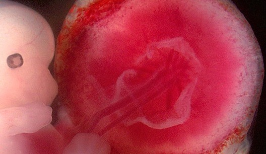660px-Fetus_and_placenta_-_journal.pbio.0060312.g001